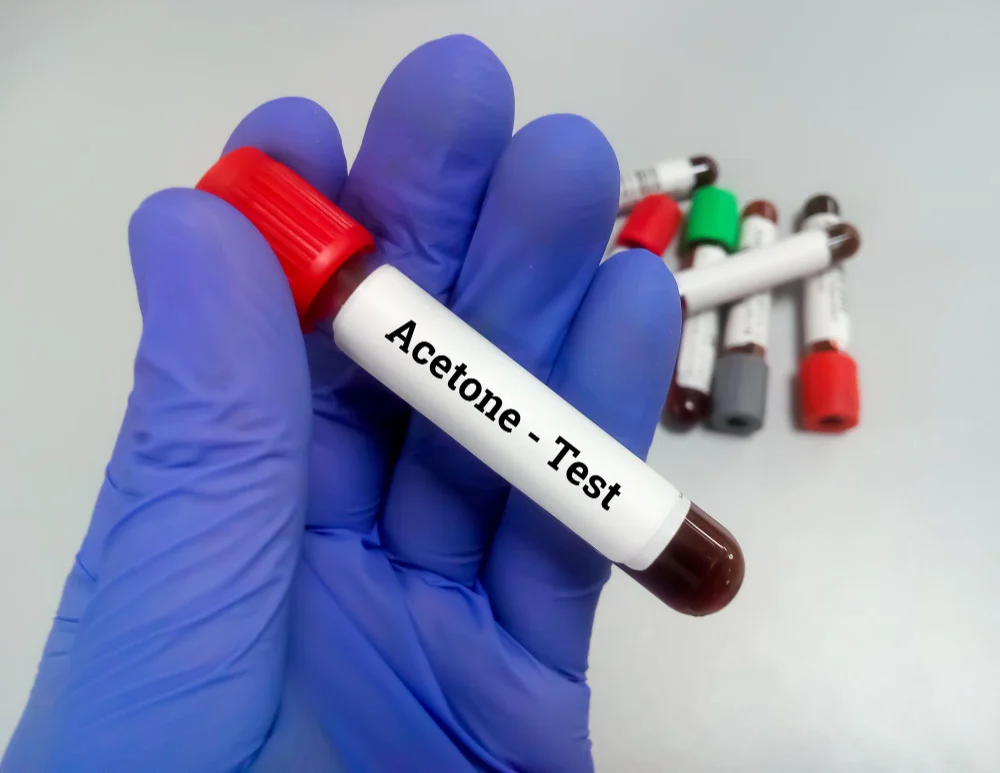 A person holding a test tube with the word actine on it.